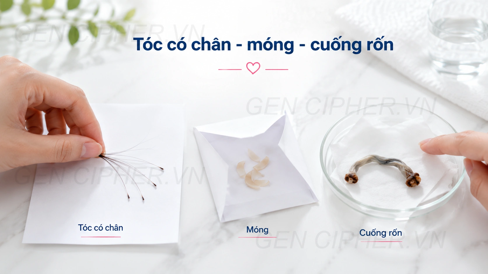Minh họa cho cách thu và bảo quản cuống rốn